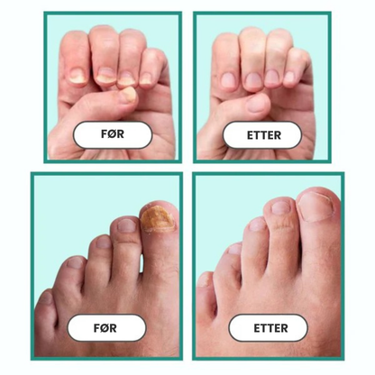 Nord Butikk | Neglepleieprodukt