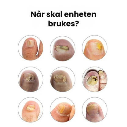 Nord Butikk | Neglepleieprodukt